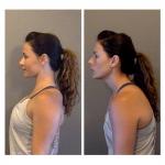 Let's create a beautiful back!  Exercises for shoulder blades.  Movements of bones and joints.  — Reduction and elevation of the shoulder blades Rule of retracted shoulder blades